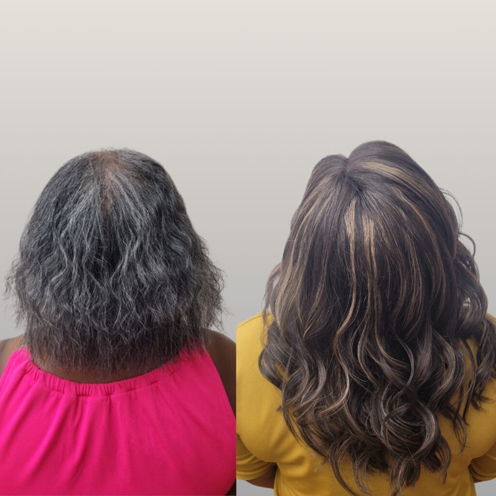 Hair Restoration Raleigh Women